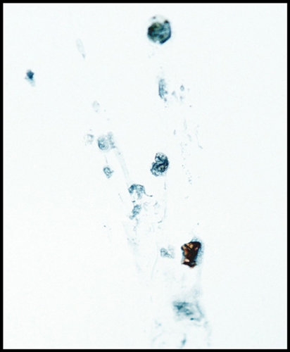 sudden_death_08